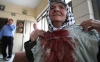 An elderly Palestinian woman shows her blood-stained dress from when settlers hit her with a stone while she was picking olives on Oct. 31, 2011.