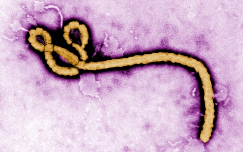 Thumbnail image for Q&A: How Ebola is transmitted and fought
