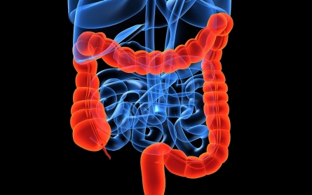 At-home test can more accurately diagnose colon cancer