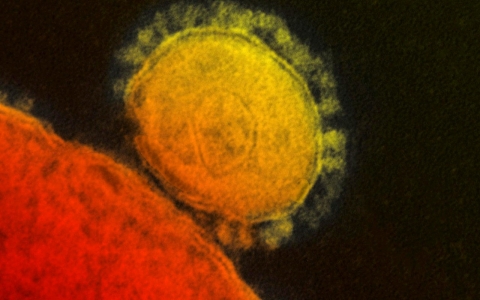 Thumbnail image for Second case of deadly MERS virus reported in the U.S.