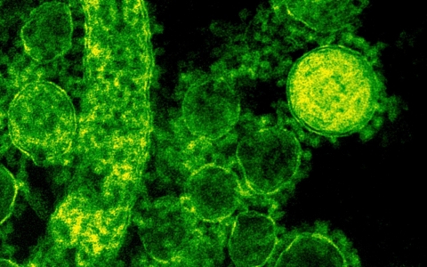 Thumbnail image for 3 more die from MERS in Saudi Arabia as Netherlands reports 2nd case