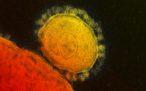 Thumbnail image for  Illinois man tests positive for MERS as more deaths noted in Saudi Arabia