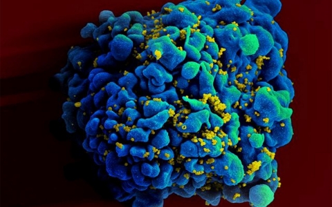 Thumbnail image for New HIV infections in gay black men may be leveling off