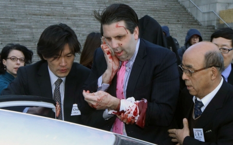 Thumbnail image for US ambassador to South Korea in stable condition after knife attack