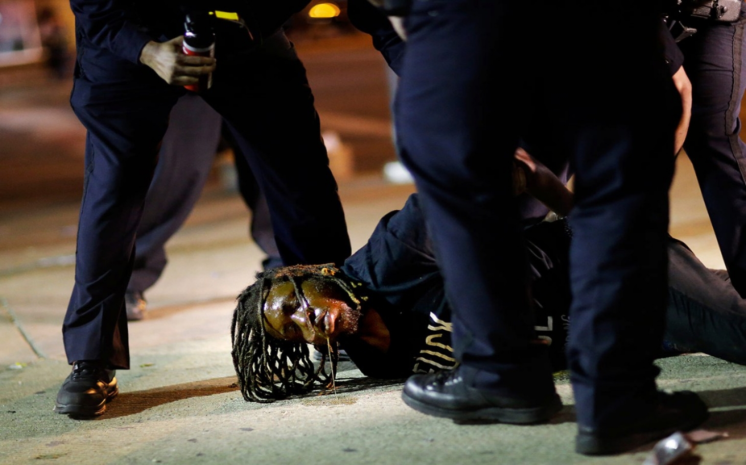 police brutality against blacks