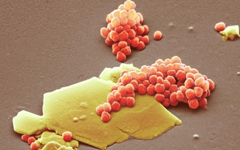 Thumbnail image for California Assembly votes to ban plastic microbeads