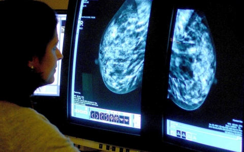 Thumbnail image for Genetic test shows which breast cancer patients can skip chemotherapy