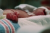 A new born in neonatal ICU.