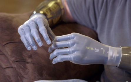 'TechKnow' i-Limb subject featured in Apple anniversary ad