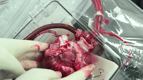 Featured image of post Heart Beating Gif Real / Please post a direct link to the gif.
